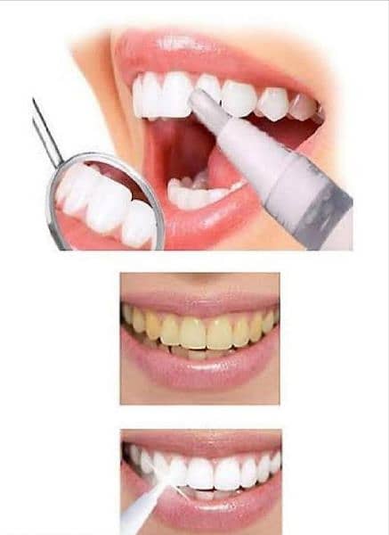 Instant teeth whitening pen Free delivery 03/00/49/13/11/0 3