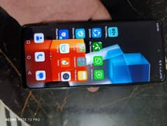 Infinix Note 10 scratch less almost brand new