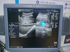 GE Logiq 7 LCD based High end Color Doppler available in ready stock