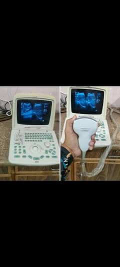 ultrasound