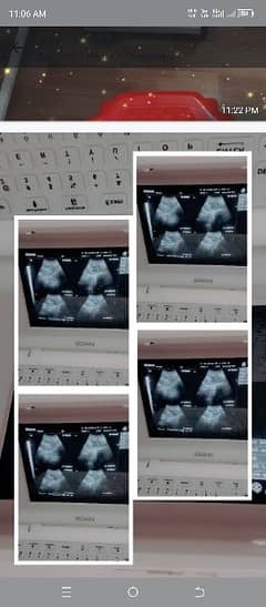 ultrasound