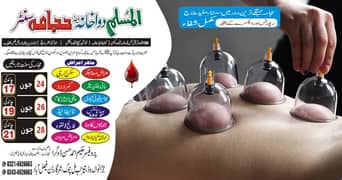 HIJAMA (Cupping Therapy) 0