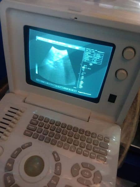 ultrasound machine for sale 1