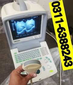 Ultrasound