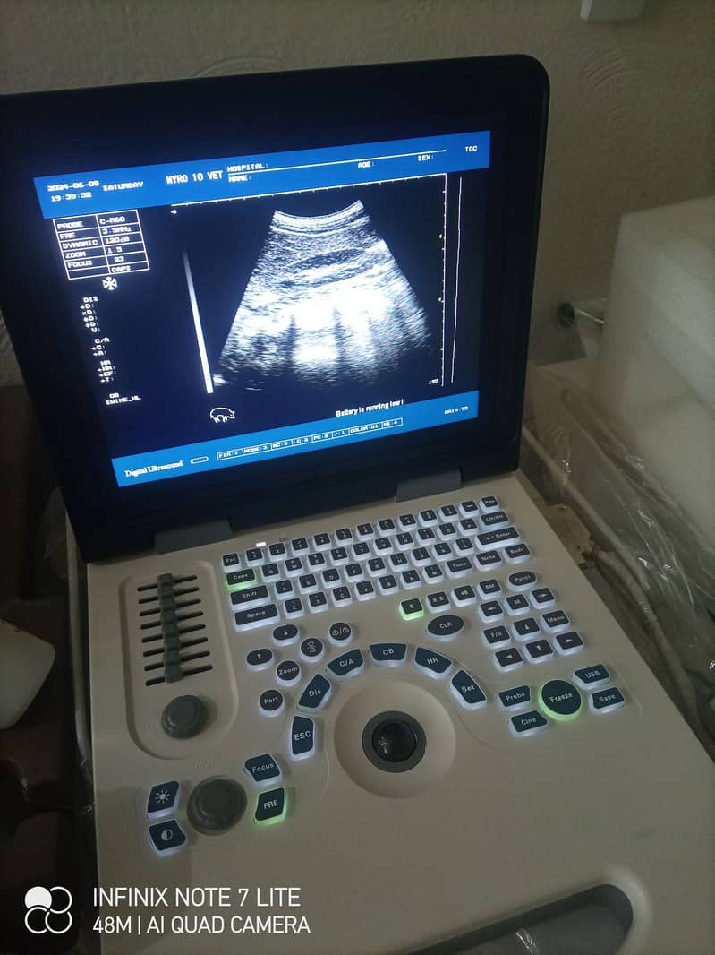 Ultrasound machine  ;Hematology analizar 1