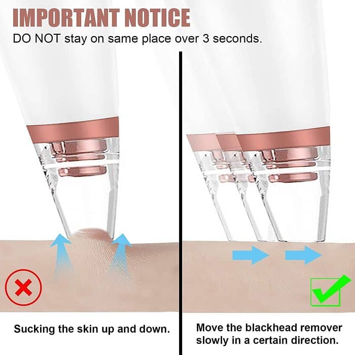 Blackhead Remover Vacuum,Pore Cleaner Electric Face Tool,Acne Extracto 1