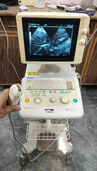 Toshiba ultrasound machine with microconvex probe 1