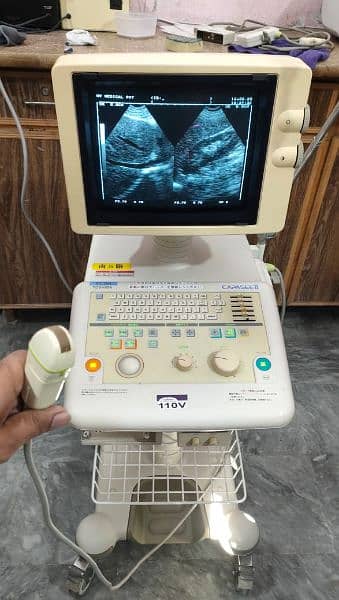 Toshiba ultrasound machine with microconvex probe 2