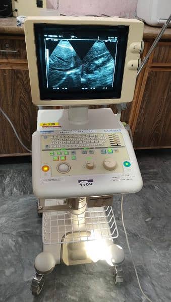 Toshiba ultrasound machine with microconvex probe 3