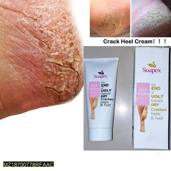 Cracked Heel cream 1