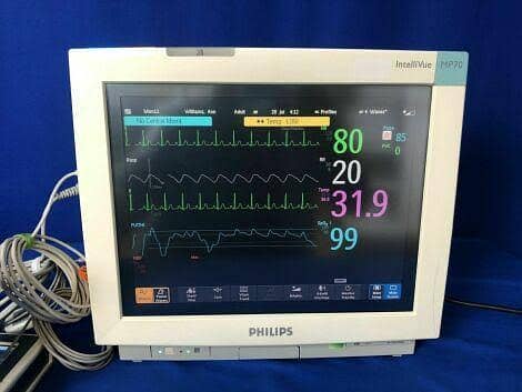 ICU Monitors OT Monitors Patient monitor Cardiac Monitors Vital Sig 8