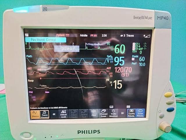 Cardiac Monitors Vital Sig  ICU Monitors OT Monitors Patient monitor 12