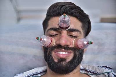 Hijama