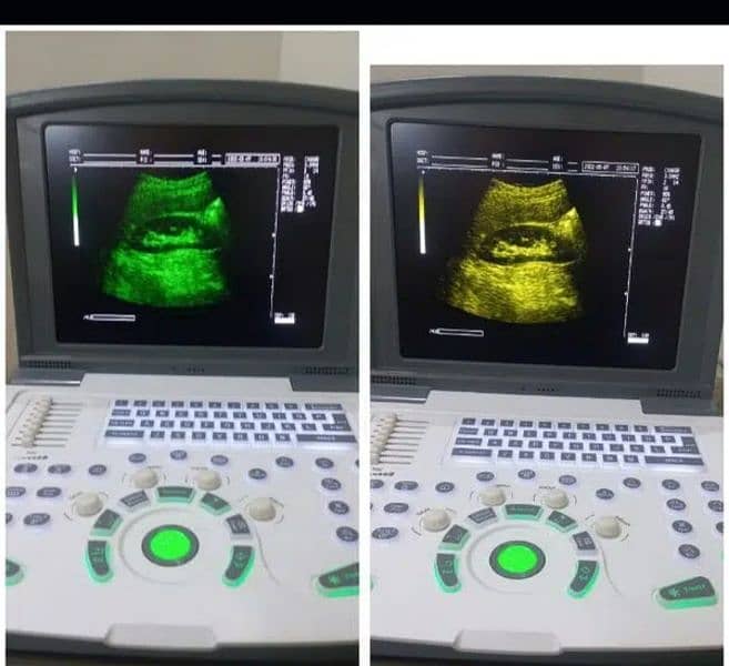 BRAND NEW 2024 MODEULTRASOUND MACHINE USED RATE MAIN 1
