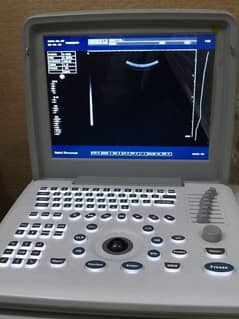 Sonotech Ultrasound machine with Sony Printer 0