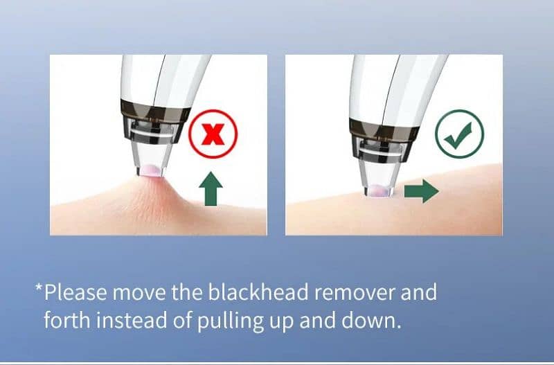 Vacuum Blackhead Remover Machine - Rechargeable Pore Cleaner - ShopNow 6
