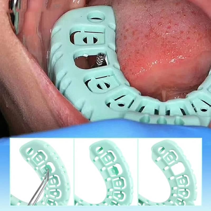 6 Pcs/set Dental Implant Tray Green Full Mouth Adult And Children Cen 4