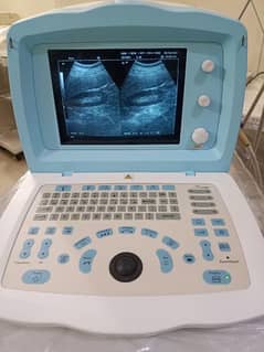 Digital Ultrasound Machine