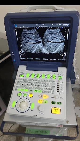 Ultrasound machines 10