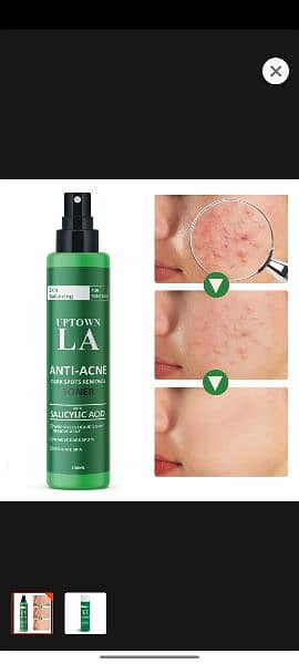 Anti Acne toner 100% result 0