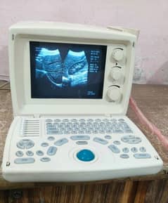 Used ultrasound machine novadex