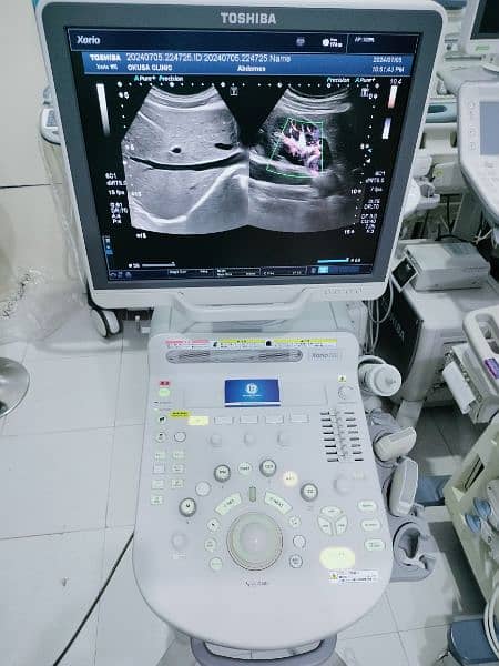 Ultrasound Machines Japani Toshiba , GE , Aloka , Philips and Hitachi 12