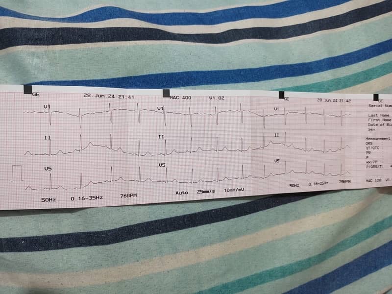 ECG Machine 2