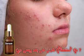 Face Serum For Removing Pimples
