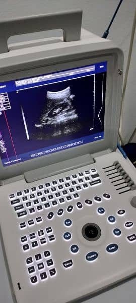 ultrasound machine ECG and printer 03/00-- 8888*965 2