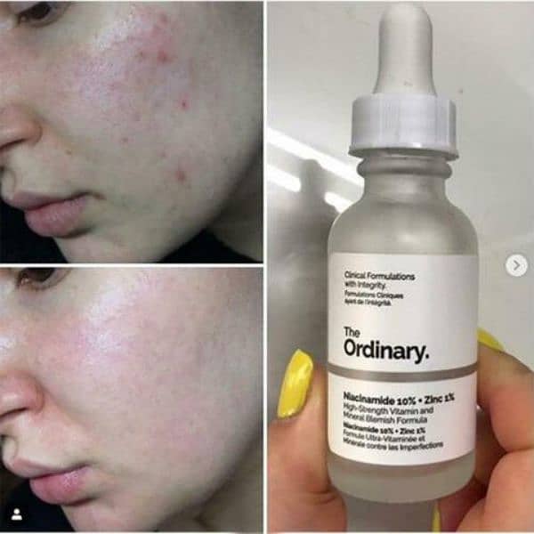 Ordinary Niacinamide 10% + Zinc 1% Whitening Moisturizing Serum 5