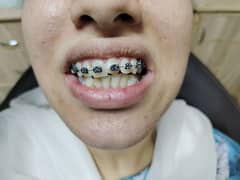 Need Female Dental Surgeon 0