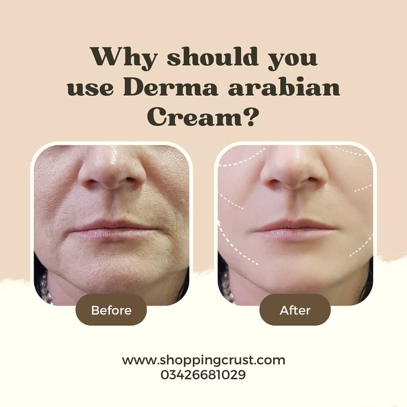 Arabian 24K Whitening And Anti-Aging Cream,Hyperpigmentation,Best crea 2