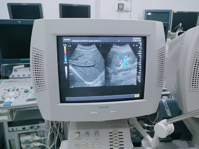 GE & Toshiba Color Doppler with Convex and Linear Probes 16