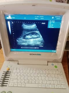 ultrasound