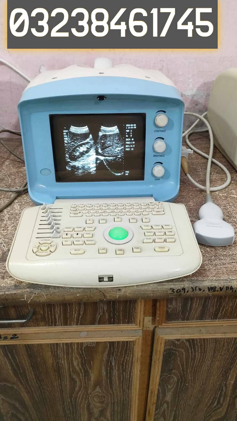 used china oriel plus ultrasound machine 0