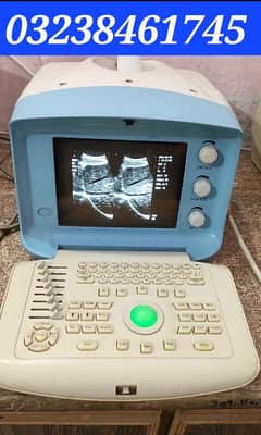 used china oriel ultrasound machine in low price