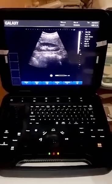 Ultrasound Machine Brand New Box Pack | 1 Year Warranty Color Doppler 2