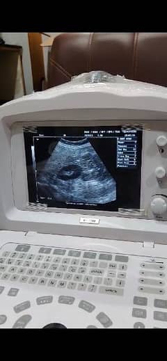 MINDRAY DP1100/DP2200 ultrasound