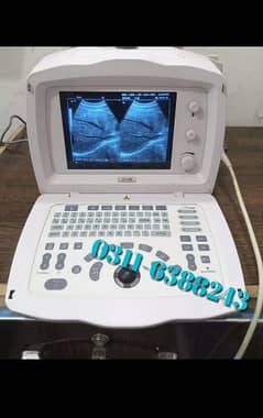 Ultrasound machine