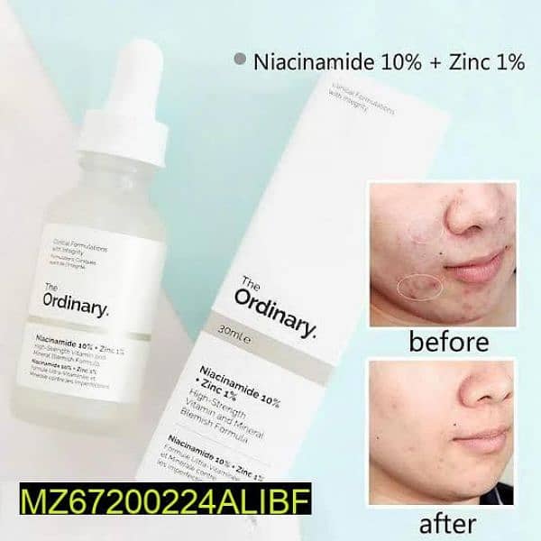 Niacinamide Skin Brightening Serum, 30 ML 2