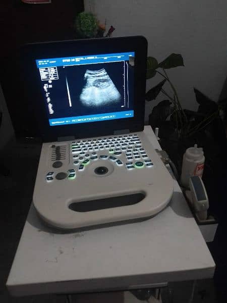 ultrasound machine 3