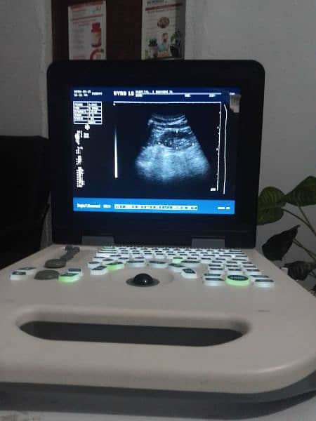 ultrasound machine 6