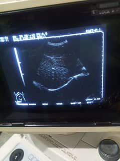 ultrasound