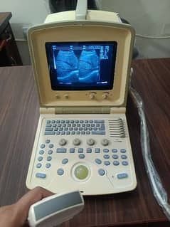 Ultrasound