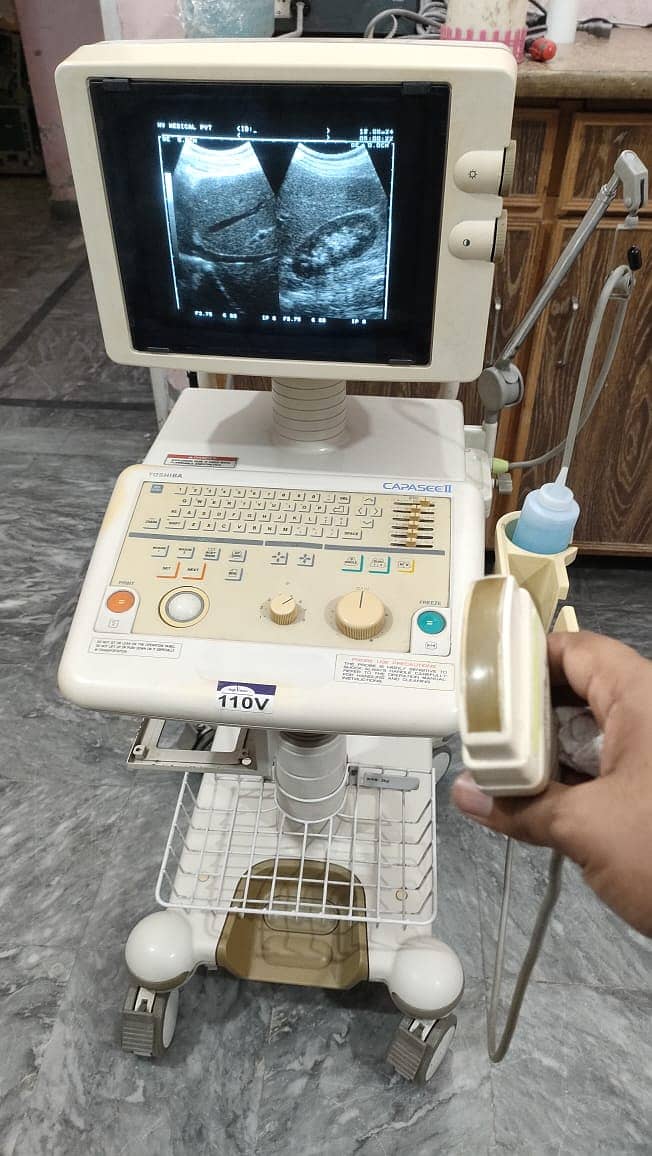 Refurb japanese grayscale ultrasound machine toshiba aloka 1