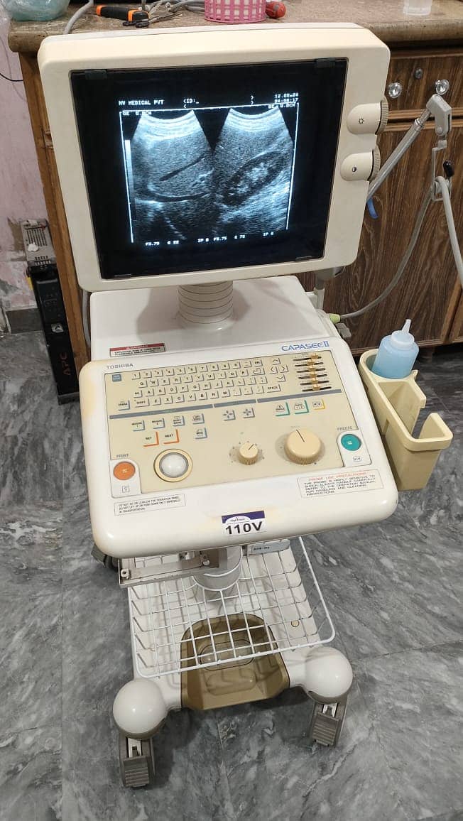 Refurb japanese grayscale ultrasound machine toshiba aloka 5