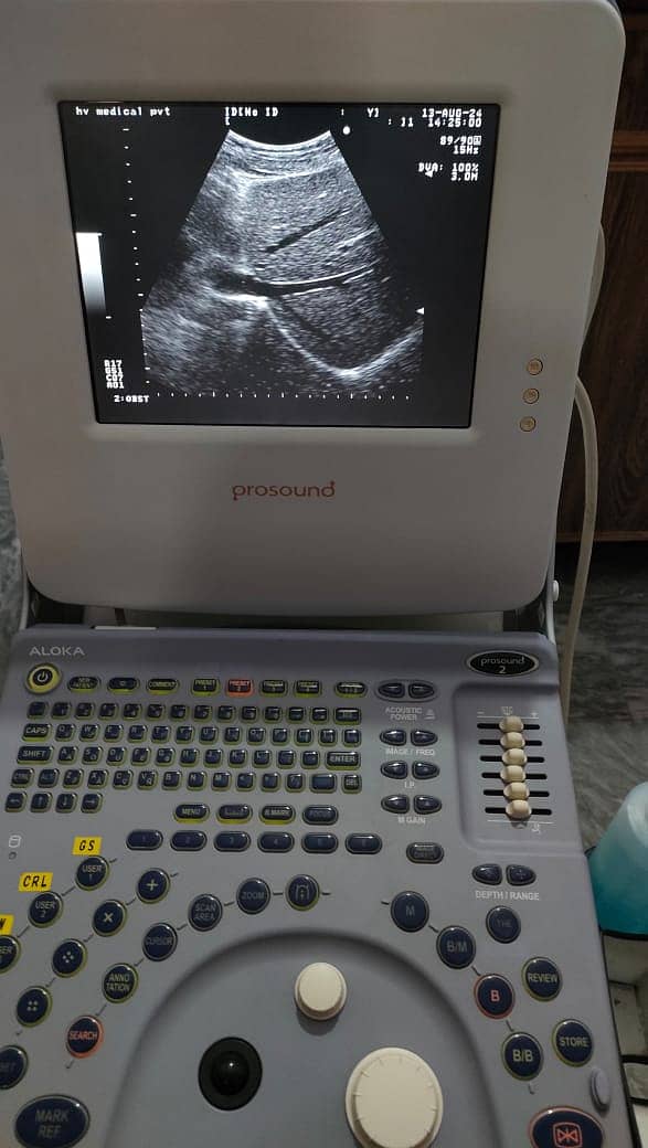 Refurb japanese grayscale ultrasound machine toshiba aloka 9