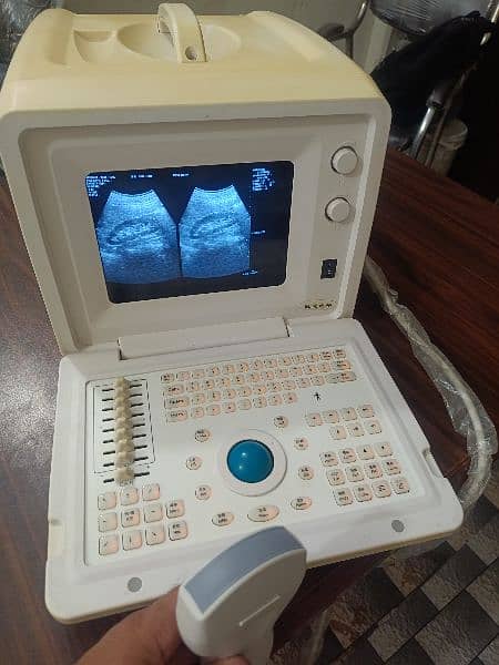 Ultrasound machine 3