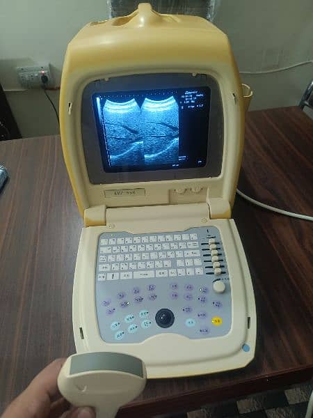 Ultrasound machine 4