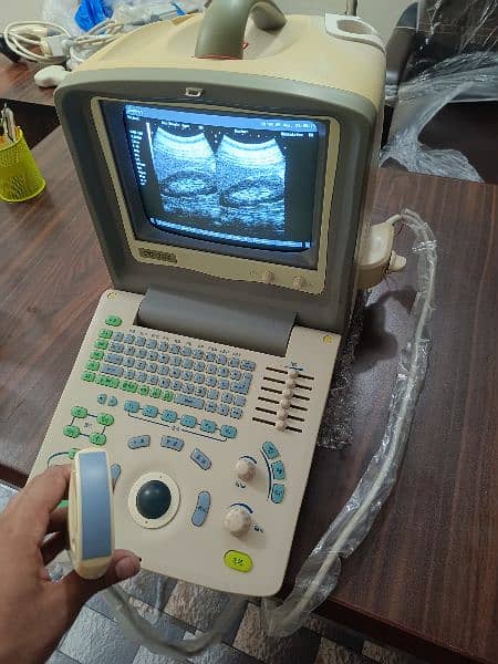 Ultrasound machine 8